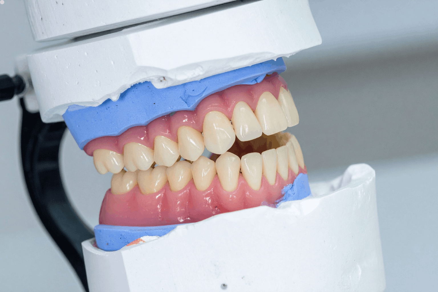 Read more about the article How to Care for Your Dentures: Tips from Denture Specialists in Manassas